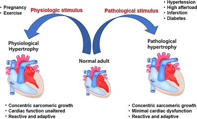 Toll-like receptors in cardiac hypertrophy